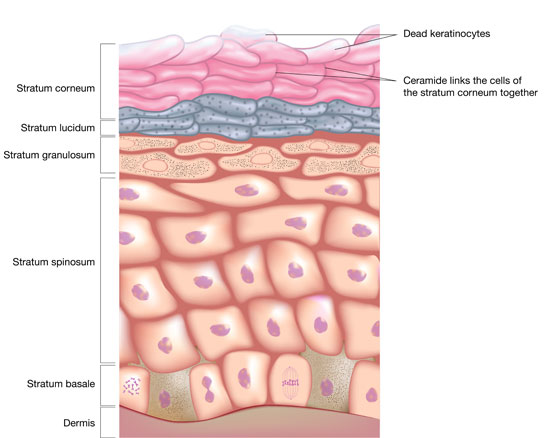 CeraPlus Peristomal Skin Challenges